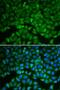 Glutathione Synthetase antibody, LS-C748543, Lifespan Biosciences, Immunofluorescence image 