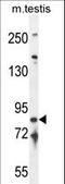 Intraflagellar Transport 81 antibody, LS-C165138, Lifespan Biosciences, Western Blot image 