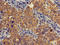 Acyloxyacyl Hydrolase antibody, LS-C498388, Lifespan Biosciences, Immunohistochemistry paraffin image 