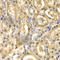 ADH4 antibody, A5454, ABclonal Technology, Immunohistochemistry paraffin image 