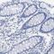 Nebulin antibody, PA5-53457, Invitrogen Antibodies, Immunohistochemistry paraffin image 