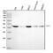 Flap Structure-Specific Endonuclease 1 antibody, M01484-4, Boster Biological Technology, Western Blot image 