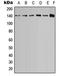 Calcium Sensing Receptor antibody, LS-C351931, Lifespan Biosciences, Western Blot image 