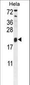 Trafficking Protein Particle Complex 3 antibody, LS-C160167, Lifespan Biosciences, Western Blot image 