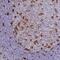 Gelsolin antibody, NBP2-55565, Novus Biologicals, Immunohistochemistry frozen image 