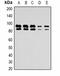 Nuclear Receptor Subfamily 3 Group C Member 1 antibody, orb334648, Biorbyt, Western Blot image 