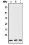 IGF Like Family Member 2 antibody, abx121625, Abbexa, Western Blot image 