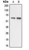 Apoptosis Antagonizing Transcription Factor antibody, MBS821781, MyBioSource, Western Blot image 