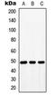 Bone Morphogenetic Protein 10 antibody, LS-C353403, Lifespan Biosciences, Western Blot image 