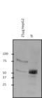 O-Linked N-Acetylglucosamine (GlcNAc) Transferase antibody, MA1-039, Invitrogen Antibodies, Immunoprecipitation image 