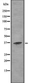 Cathepsin H antibody, abx149620, Abbexa, Western Blot image 