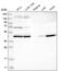 Kelch Repeat And BTB Domain Containing 2 antibody, NBP1-88588, Novus Biologicals, Western Blot image 