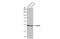 RAB6A, Member RAS Oncogene Family antibody, GTX635981, GeneTex, Western Blot image 