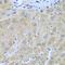 Furin, Paired Basic Amino Acid Cleaving Enzyme antibody, GTX55628, GeneTex, Immunohistochemistry paraffin image 
