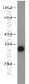 Collagen Triple Helix Repeat Containing 1 antibody, 16534-1-AP, Proteintech Group, Western Blot image 
