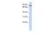 Transferrin Receptor 2 antibody, GTX46552, GeneTex, Western Blot image 