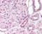 Suppression Of Tumorigenicity 14 antibody, 49-734, ProSci, Immunohistochemistry paraffin image 