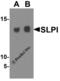 Secretory Leukocyte Peptidase Inhibitor antibody, 4251, ProSci, Western Blot image 