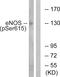 Nitric Oxide Synthase 3 antibody, LS-C198919, Lifespan Biosciences, Western Blot image 