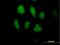 Mixed Lineage Kinase Domain Like Pseudokinase antibody, H00197259-B01P, Novus Biologicals, Immunocytochemistry image 