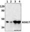 Zinc Finger Protein 24 antibody, A06529, Boster Biological Technology, Western Blot image 