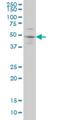 SRY-Box 3 antibody, H00006658-M04, Novus Biologicals, Western Blot image 