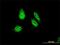 Rhox Homeobox Family Member 1 antibody, H00158800-M01, Novus Biologicals, Immunocytochemistry image 