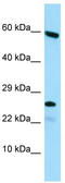 Heparan-Alpha-Glucosaminide N-Acetyltransferase antibody, TA337879, Origene, Western Blot image 