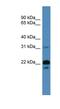 Brain Abundant Membrane Attached Signal Protein 1 antibody, NBP1-68958, Novus Biologicals, Western Blot image 