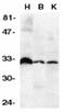 TNF Receptor Superfamily Member 6b antibody, LS-C314, Lifespan Biosciences, Western Blot image 