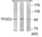 General Transcription Factor IIIC Subunit 2 antibody, EKC1884, Boster Biological Technology, Western Blot image 
