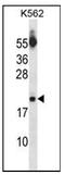 Histone deacetylase complex subunit SAP18 antibody, AP53795PU-N, Origene, Western Blot image 