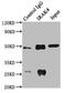 Interleukin 1 Receptor Associated Kinase 4 antibody, LS-C375972, Lifespan Biosciences, Immunoprecipitation image 