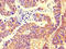 SH3 Domain Binding Protein 5 antibody, orb46091, Biorbyt, Immunohistochemistry paraffin image 