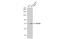 Zinc Finger And BTB Domain Containing 20 antibody, GTX121616, GeneTex, Western Blot image 