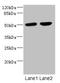 Cholinergic Receptor Nicotinic Alpha 10 Subunit antibody, LS-C675528, Lifespan Biosciences, Western Blot image 