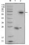 R-Spondin 1 antibody, A02857, Boster Biological Technology, Western Blot image 