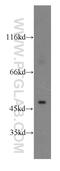 Chitobiase antibody, 12599-1-AP, Proteintech Group, Western Blot image 