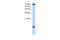 Ubiquitin Conjugating Enzyme E2 N antibody, 27-794, ProSci, Western Blot image 