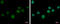 Zinc Finger Protein 501 antibody, GTX116521, GeneTex, Immunocytochemistry image 