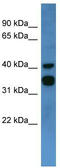 Coagulation Factor II Thrombin Receptor Like 2 antibody, TA342829, Origene, Western Blot image 