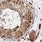 Glyoxylate Reductase 1 Homolog antibody, NBP2-38618, Novus Biologicals, Immunohistochemistry paraffin image 