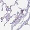 Acid Phosphatase 5, Tartrate Resistant antibody, HPA057655, Atlas Antibodies, Immunohistochemistry paraffin image 