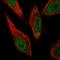 ZFP69 Zinc Finger Protein B antibody, HPA044289, Atlas Antibodies, Immunofluorescence image 