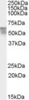 Thyroid Hormone Receptor Alpha antibody, PA5-18777, Invitrogen Antibodies, Western Blot image 