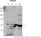 Tyrosyl-DNA Phosphodiesterase 2 antibody, TA331907, Origene, Western Blot image 