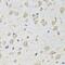 Proteasome 26S Subunit, ATPase 2 antibody, FNab06878, FineTest, Immunohistochemistry paraffin image 