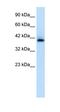 HEXIM P-TEFb Complex Subunit 1 antibody, orb329779, Biorbyt, Western Blot image 