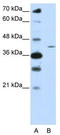 Zinc Finger Protein 488 antibody, TA345571, Origene, Western Blot image 