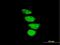 Zinc Finger Protein 133 antibody, H00007692-B01P, Novus Biologicals, Immunocytochemistry image 